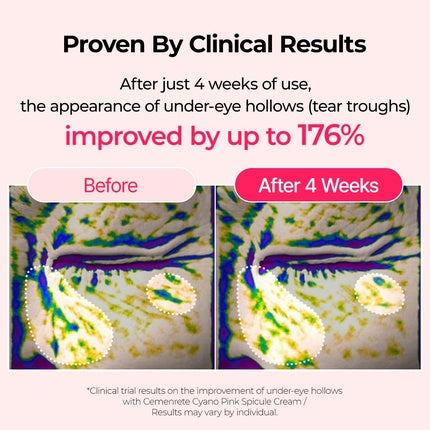 Cemenrete Cyano Pink Spicule Cream with Calcium and Vitamin B12 for Under Eyes