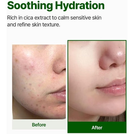 Nacific Cica PDRN First Toner 150ml with Centella Asiatica