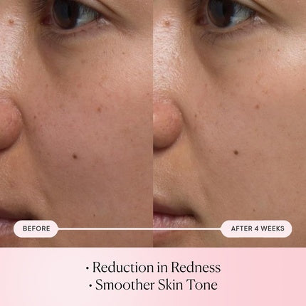 ELEMIS Pro-Collagen Rose Micro Serum Hydration Serum for Plumping, Soothing, and Nourishing Skin - Reduce Fine Lines and Wrinkles